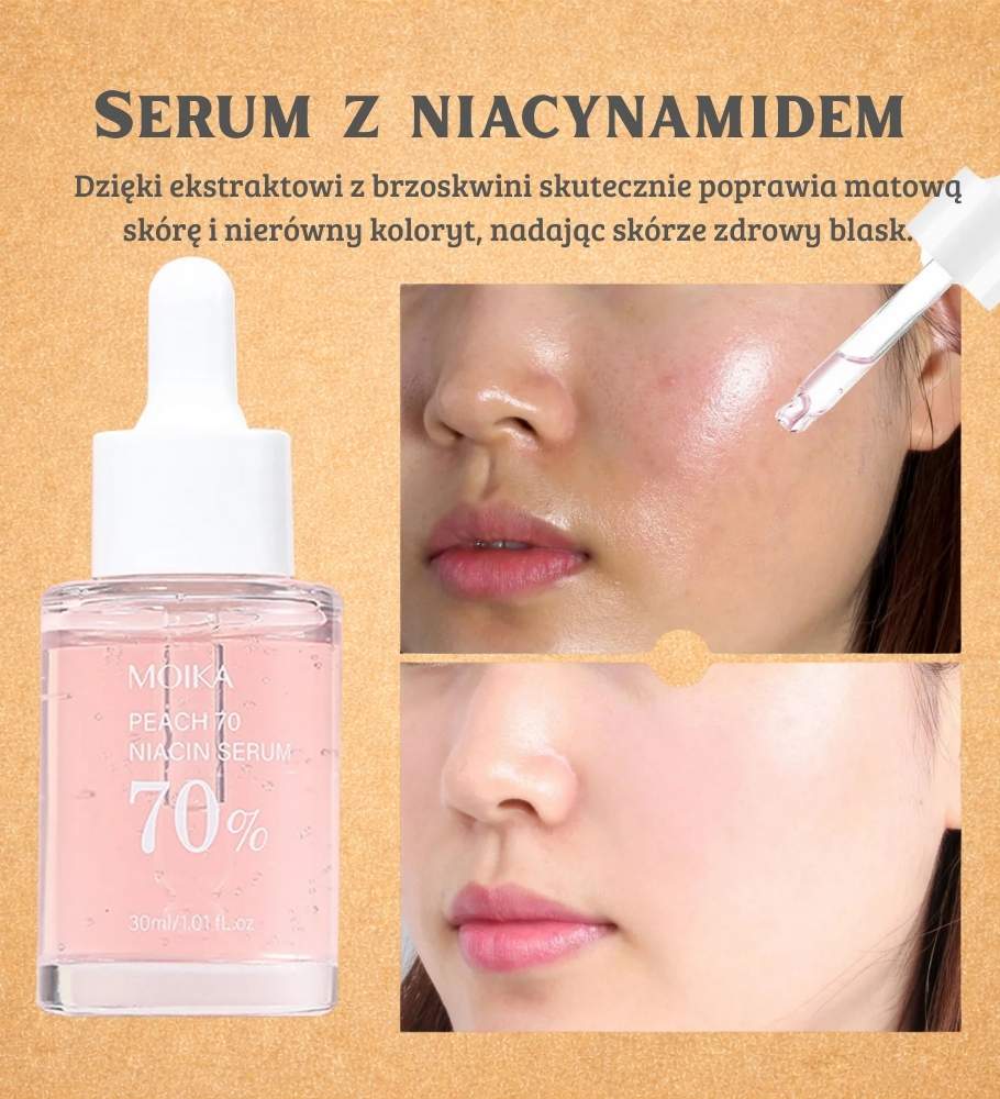 MOIKA | Niacinamide Serum