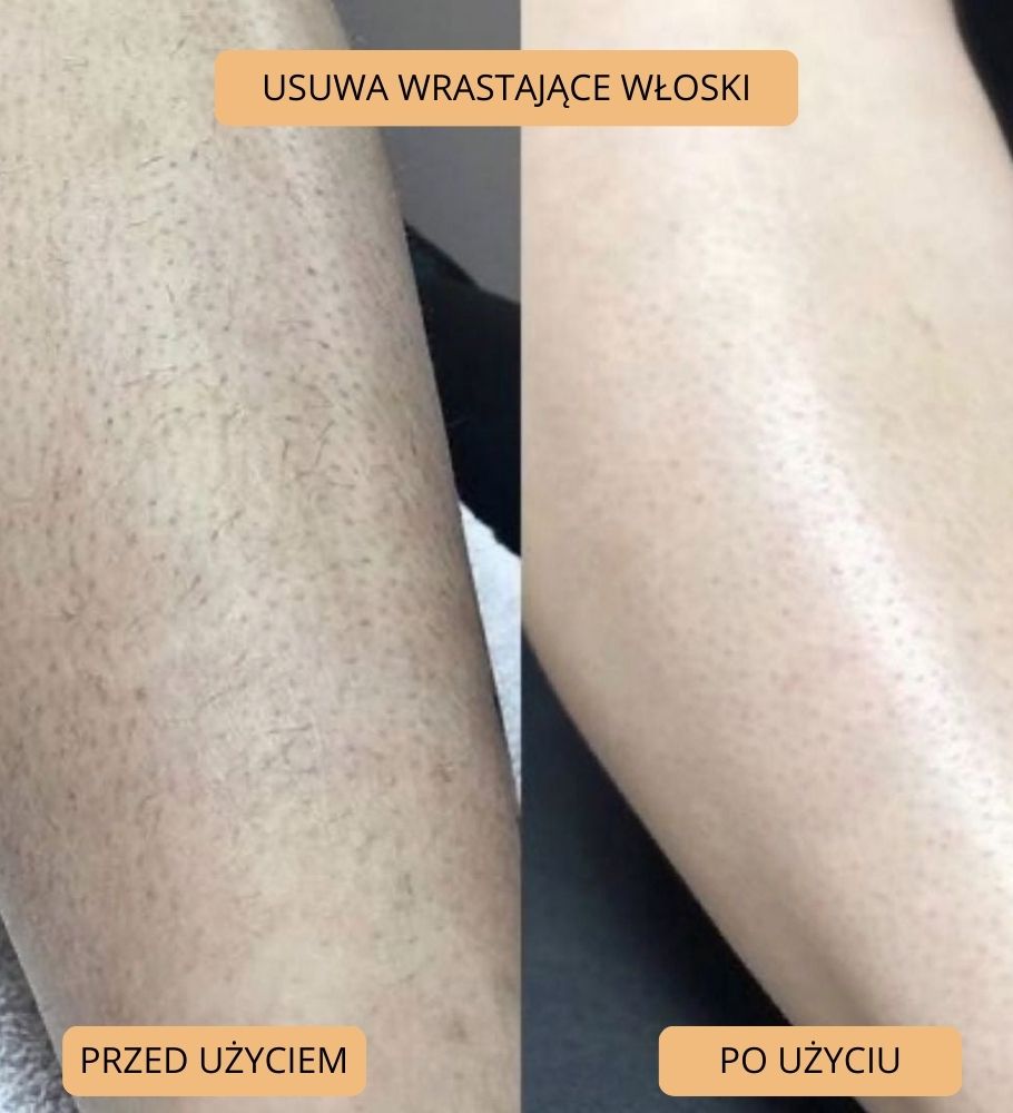 Jedwabna Skóra | Nano Kamień Kryształowy